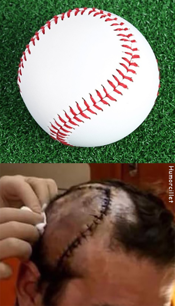 pelota beisbol